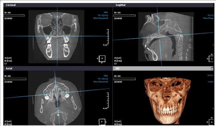 CBCT Imaging
