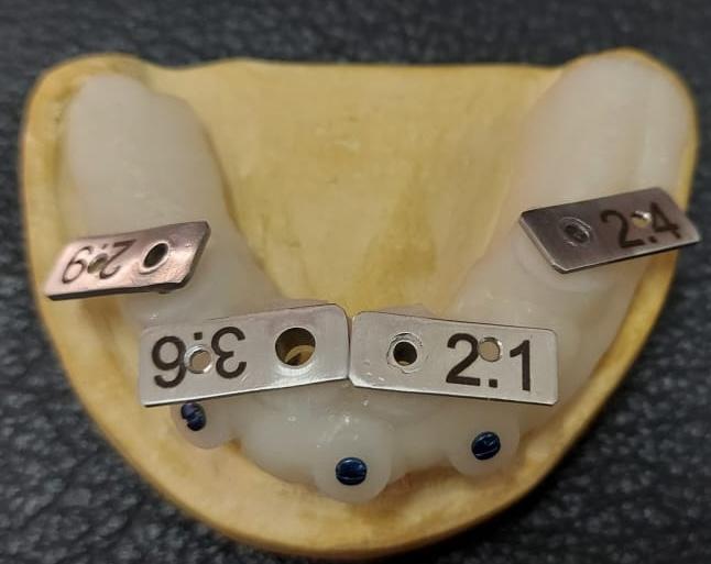 Digital implant planning software interface